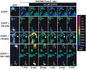 Ca2+ Imaging of Rat Medium Spiny Neurons