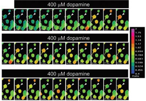 Dopamine-induced Ca2+ Transients in Rat MSN